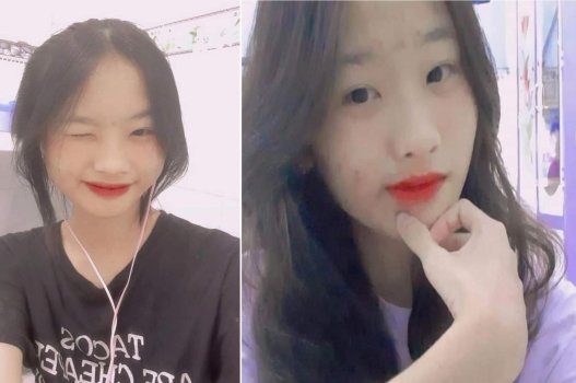 Da mặt có mụn nhưng em nữ sinh vẫn xinh đẹp